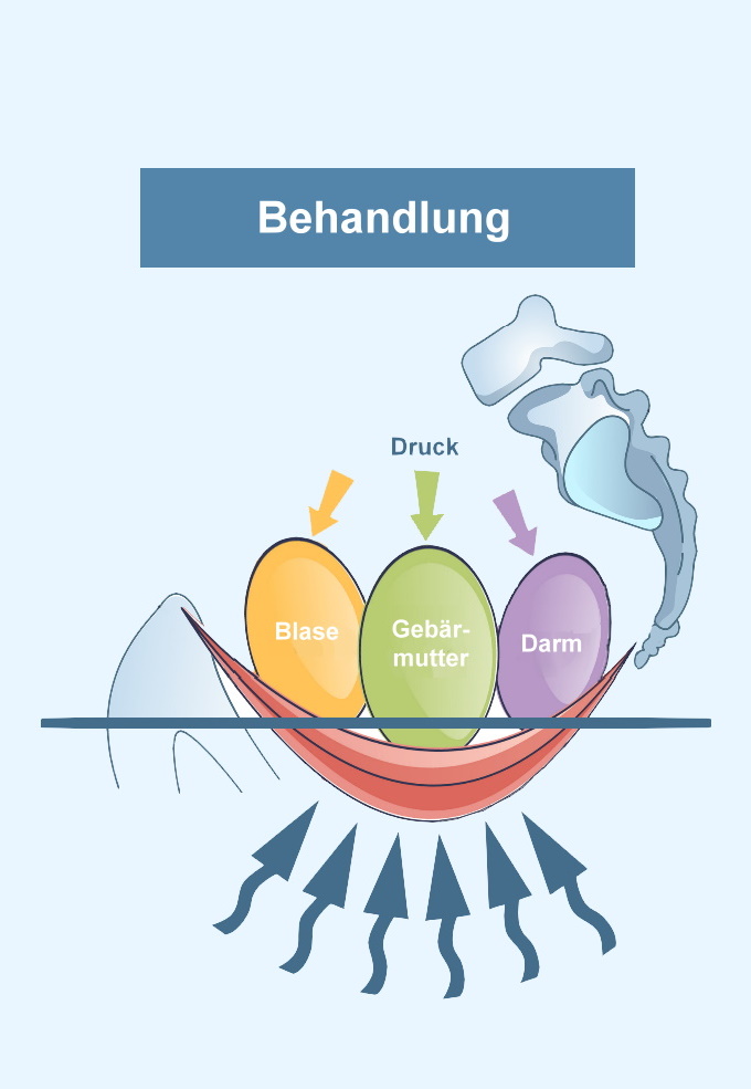 Beckenbodentherapie in Bonn