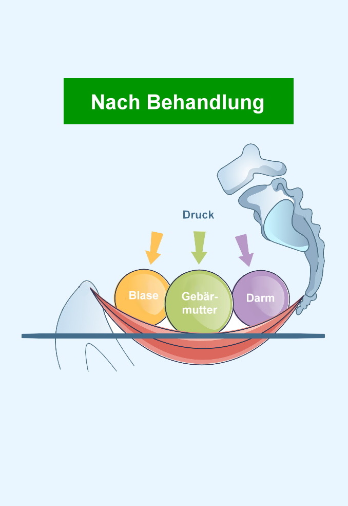 Beckenbodengymnastik in Bonn